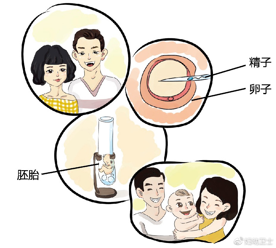 无卵试管婴儿
