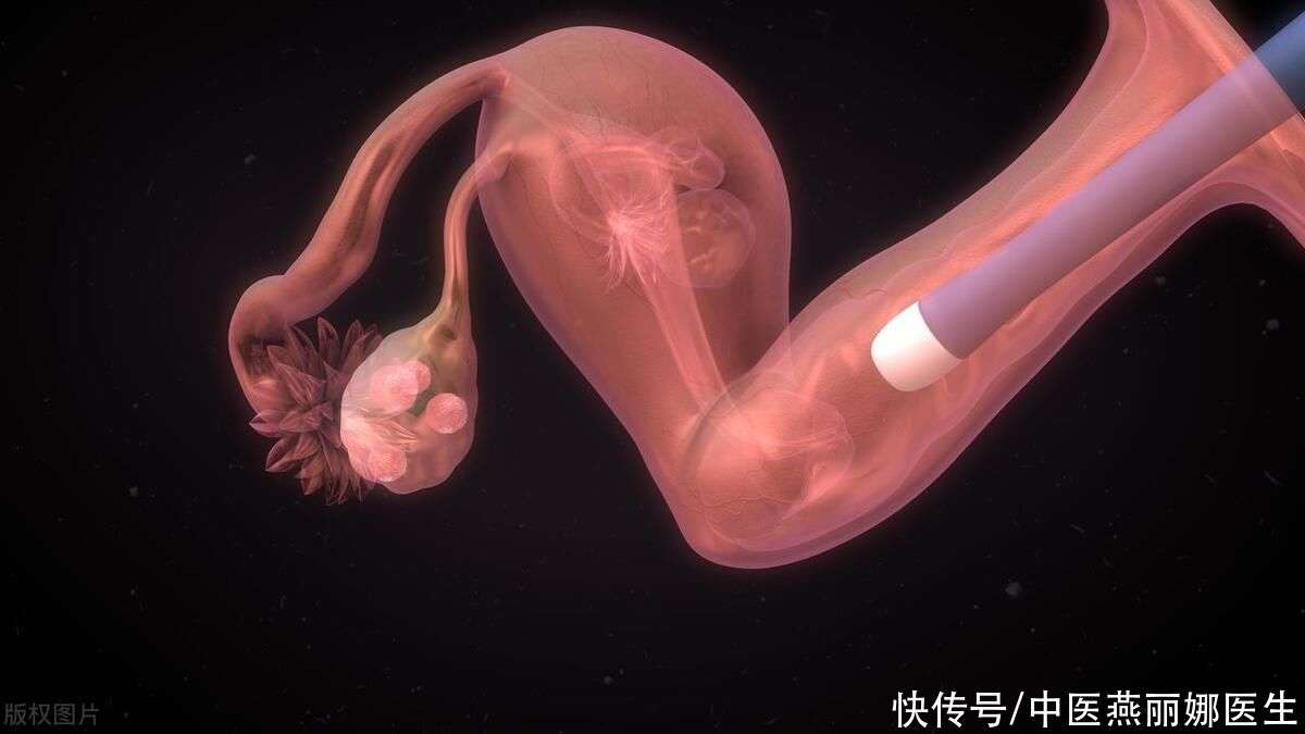 代孕